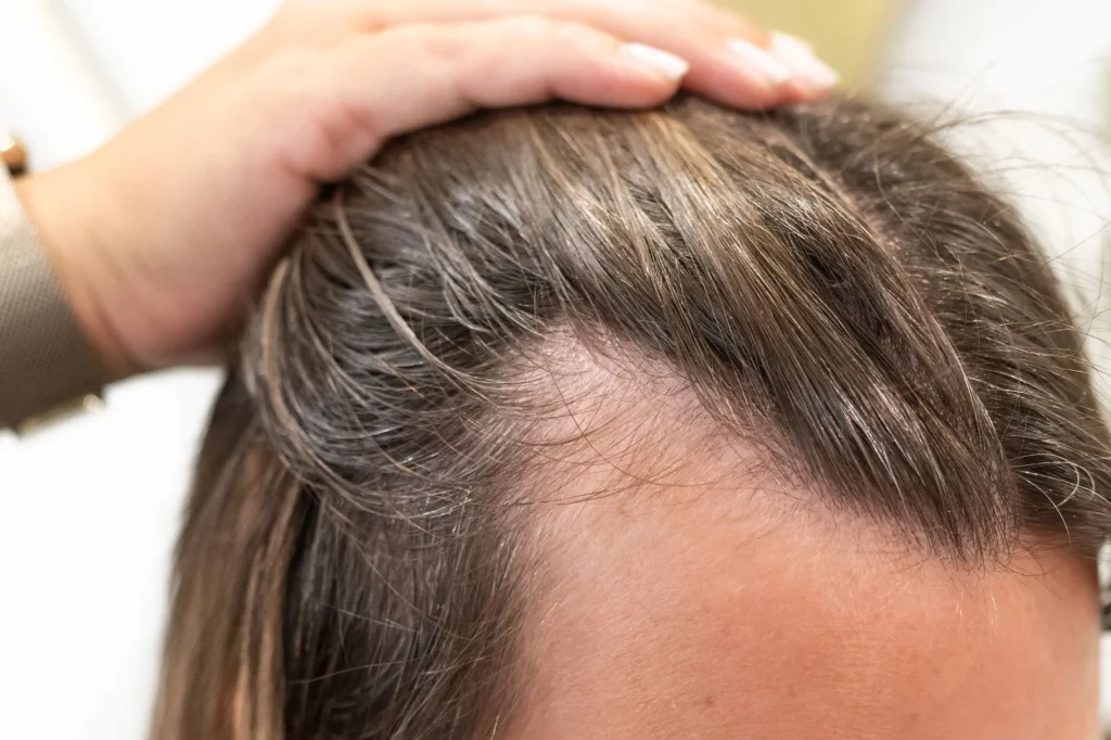 what are baby hairs what are baby hairs